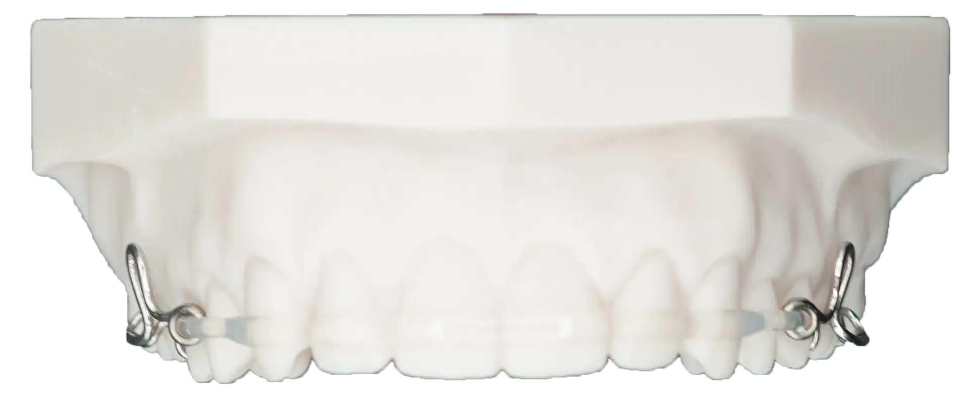 ClearBow Retainer 3
