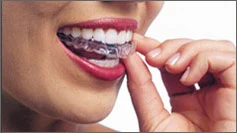 Essix Retainer 2