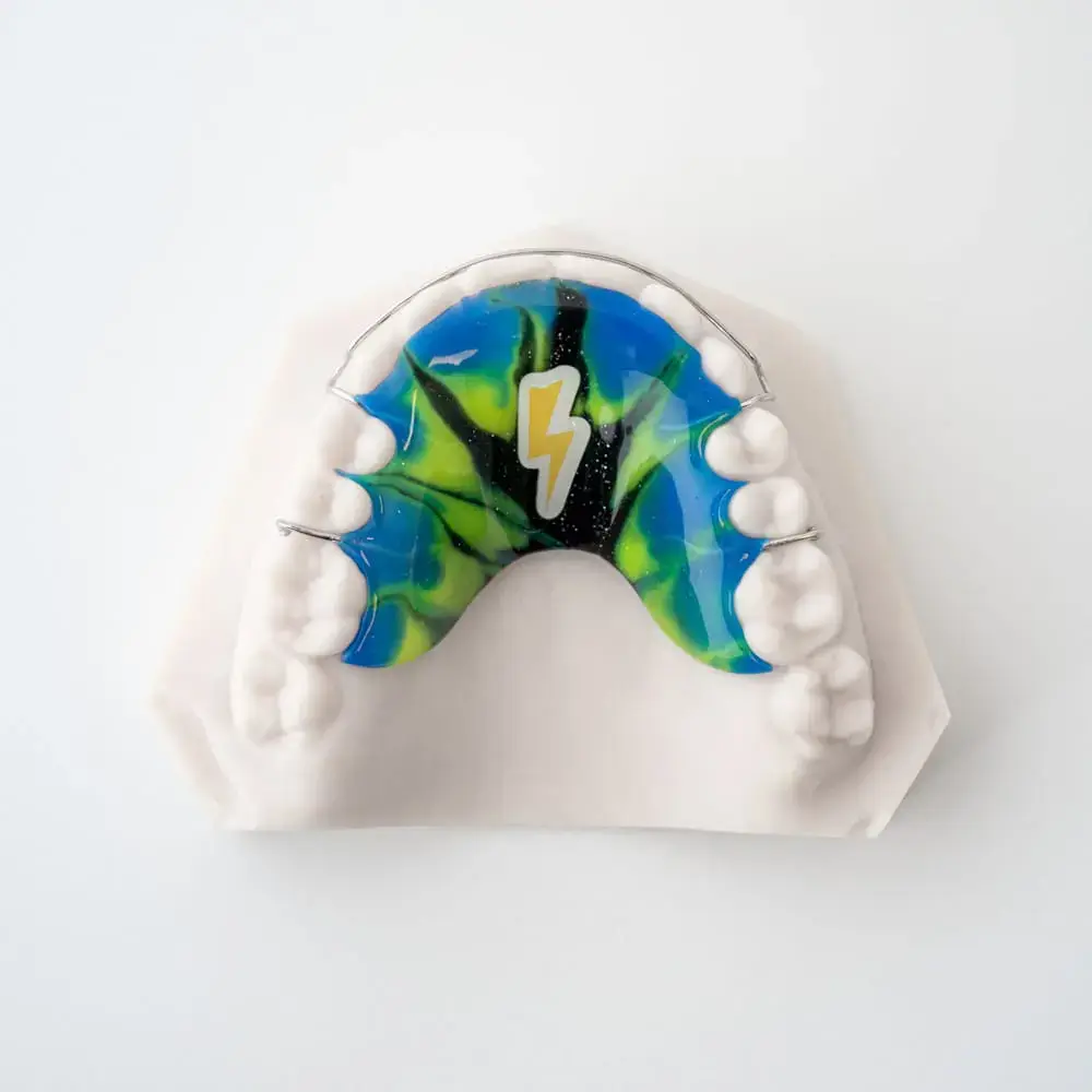 Hawley Retainer Design 5