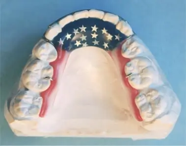 Hawley Retainer Design 6