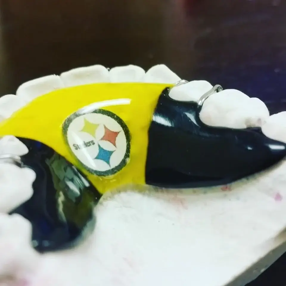 Hawley Retainer Design 7