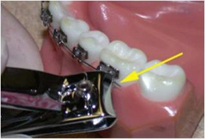 Clipping wire with nail clippers