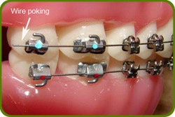 Identifying a poking wire